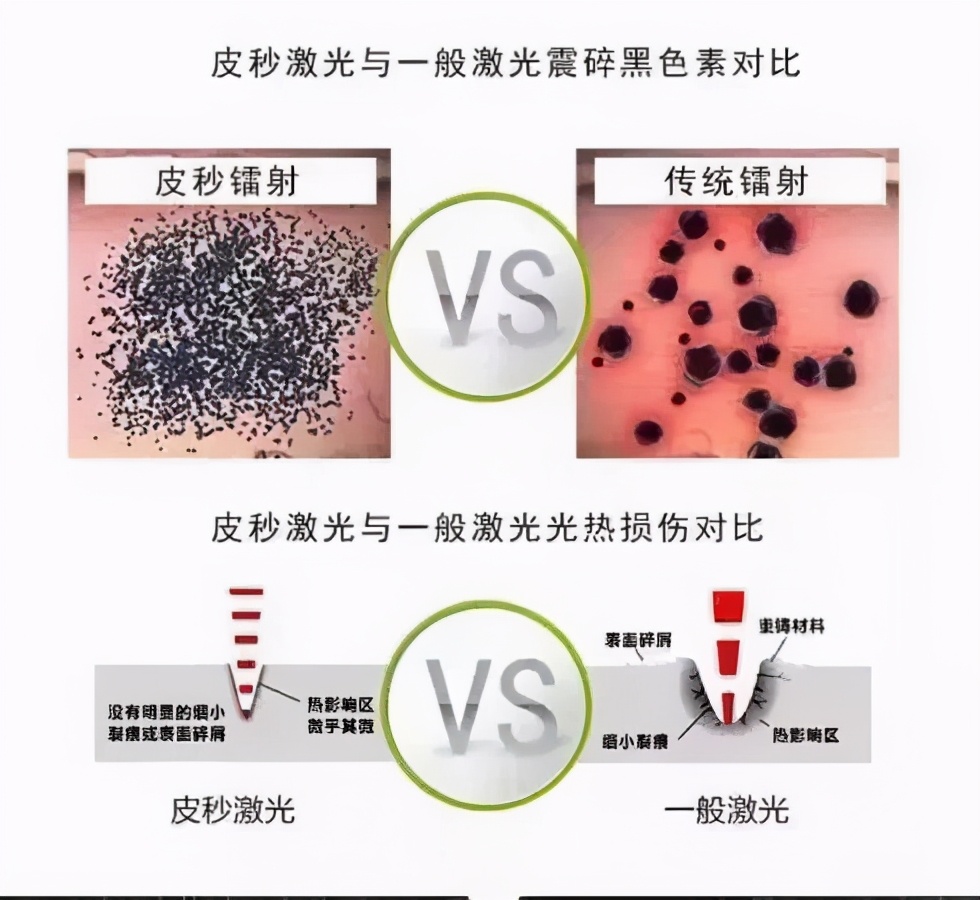 堪比整容的美容方法,堪比磨皮的医美