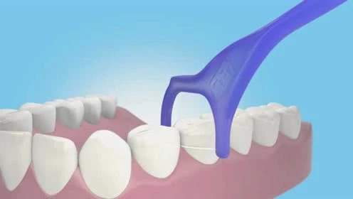 为什么牙医建议不要经常用漱口水,为什么牙医不建议用牙线棒