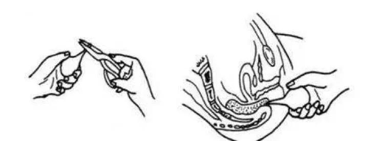 为什么猫用开塞露会上瘾,用了开塞露为什么会上瘾