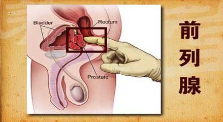 前列腺炎白细胞少许是正常吗,前列腺炎检查有白细胞正常吗