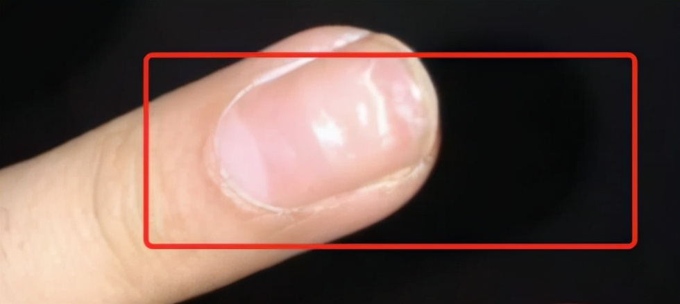 化疗后患者身体差,化疗身体扛不住还有继续的必要吗