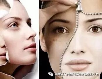 激光祛斑后更黑了怎么办,做了激光祛斑为什么皮肤会痒