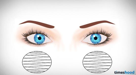 7岁就近视了该怎么办,7岁就近视了以后该怎么办