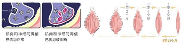 瘦脸针小v脸几天见效果,瘦脸针打完后几天出效果