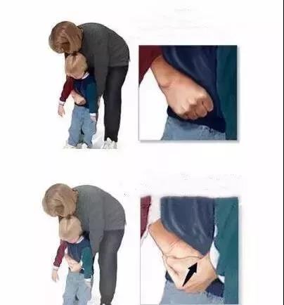 女孩误吞玩具,女童误吞了小玩具电池怎么办