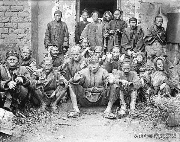 卢照邻麻风病,唐代孙思邈治过卢照邻的麻风病吗