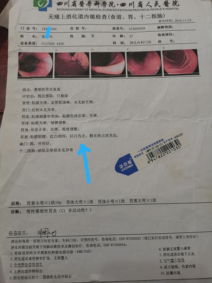 一个逆转的萎缩性胃炎患者自述,萎缩性胃炎被逆转了