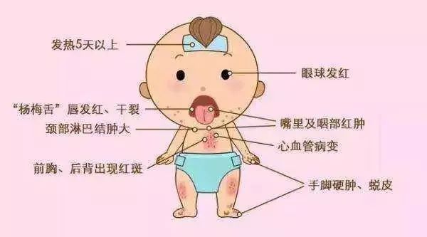 婴儿发烧3天了还不退烧怎么办,15岁孩子高烧一天没退是什么原因