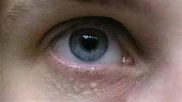 眼霜越用越贵还有黑眼圈怎么办,眼霜是越贵越好吗