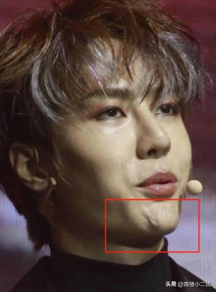 武汉协和医院整容,武汉协和整容