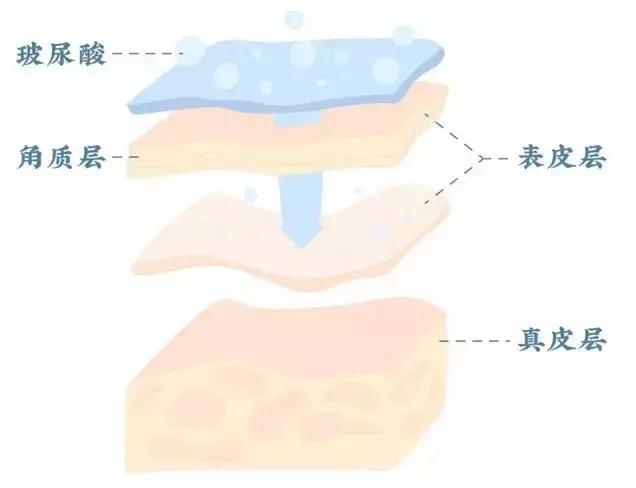 玻尿酸护肤品功效与作用,玻尿酸成分护肤品有用吗