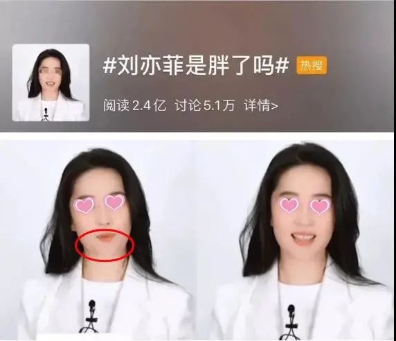 双下巴显脸大怎么改善,双下巴很明显但是不胖