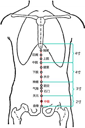 盆腔炎用针灸治疗效果好吗,针灸治疗盆腔炎
