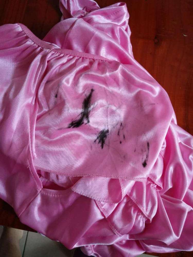 衣服从洗衣机洗出来有污渍怎么办,衣服顽固污渍洗不掉有什么好方法