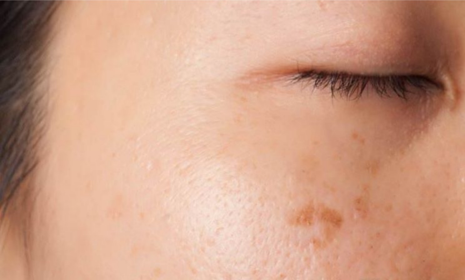 导致皮肤暗黄的原因,皮肤暗黄六大因素