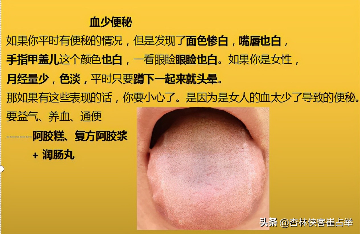 中医怎么治疗肠蠕动慢引起的便秘,糖尿病人长期便秘的中医解决方法