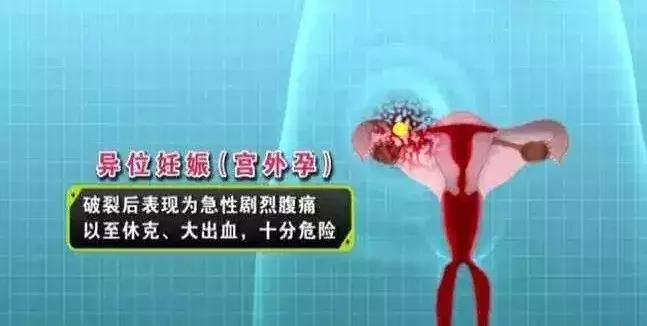千万不要拿生命去发生性关系!这些3·8女神节的病例敲响警钟!