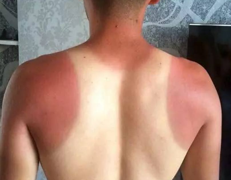 夏季高温跑步注意什么,夏天天气热该怎么跑步