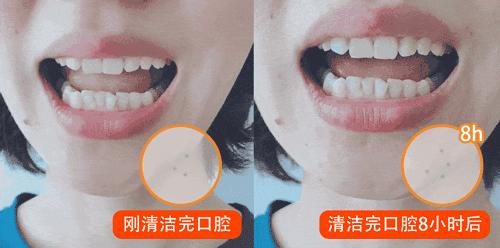 口腔专用香水,能持久留香的口腔香水