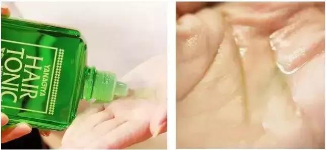 发际线高头发稀疏掉头发怎么拯救,发际线后移的头发还能长出来么