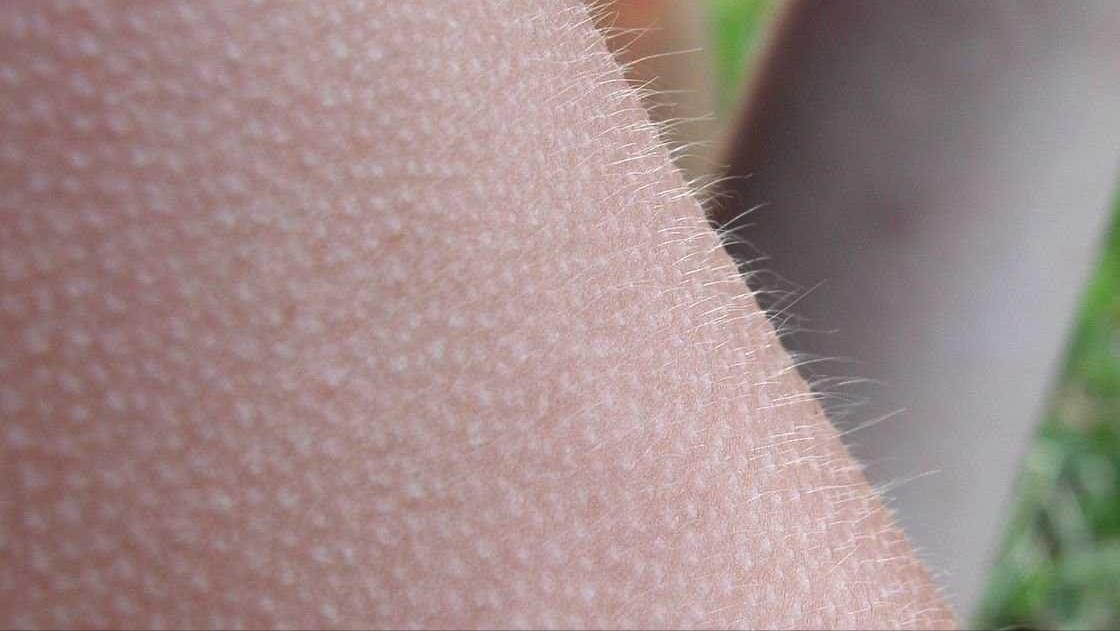 低温下的“微笑死亡”，面对突发的低温天气，我们该如何避免失温