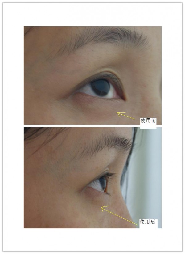 兰蔻和雅诗兰黛眼部精华液哪个好,兰蔻眼部肌底精华液和兰蔻眼霜