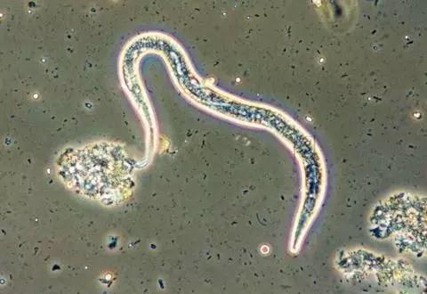 根结线虫病害及治疗方法,根结线虫危害全过程