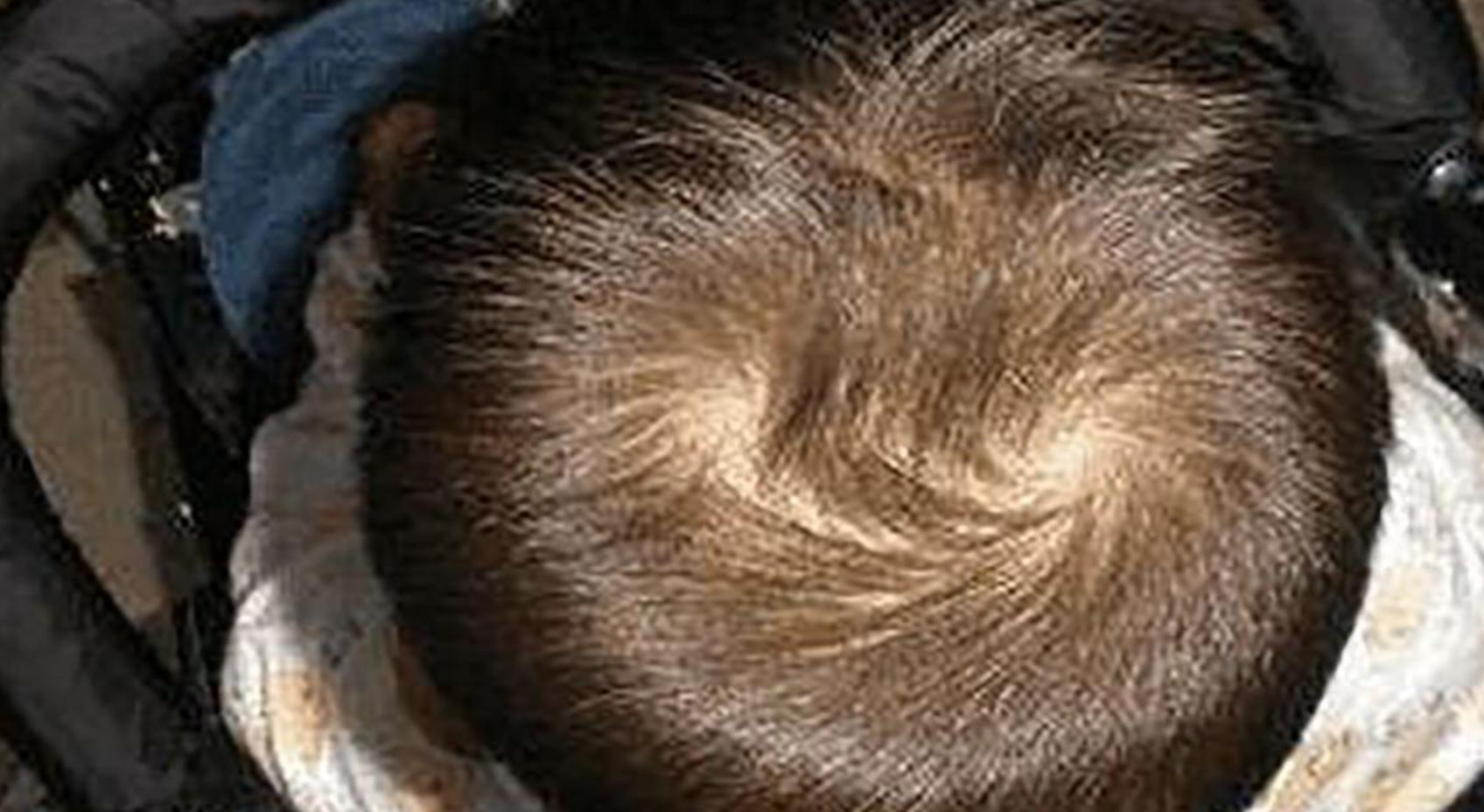 “双旋男孩找不到，双旋女孩没人要”，关于头上的旋，这几点要懂