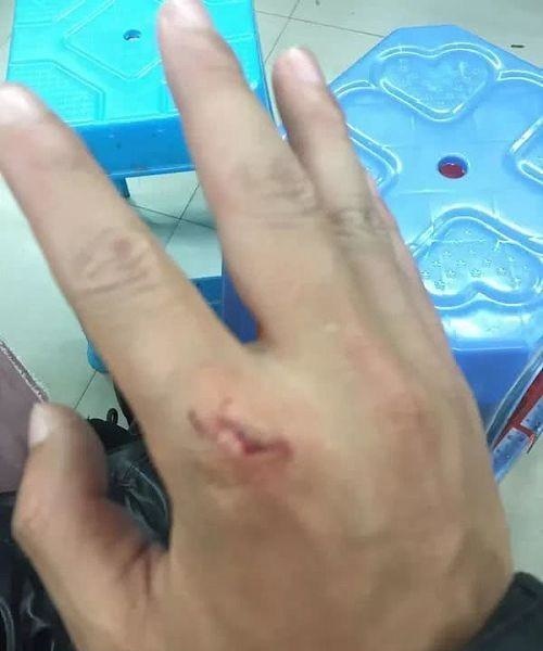 “帮我买两个不锈钢脸盆”接到这个订单外卖小哥果断报警