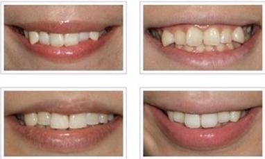 雅虎是什么意思啊,牙虎是什么