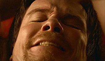 欧洲水银疗法治梅毒,放血治梅毒穴位