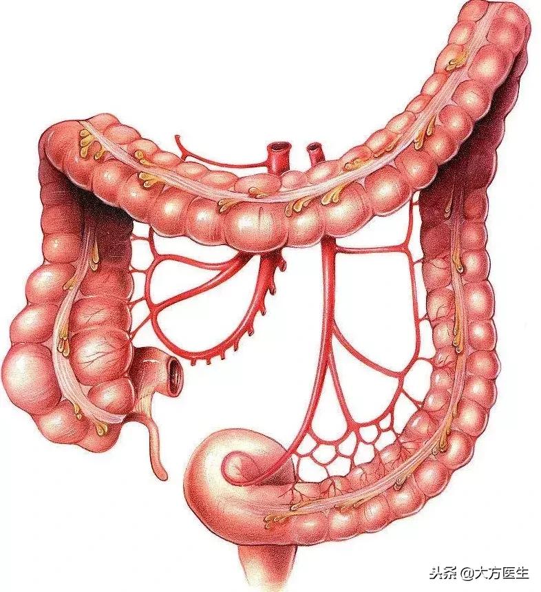 结肠癌晚期转移脑部的表现,结肠癌晚期肠梗阻的表现