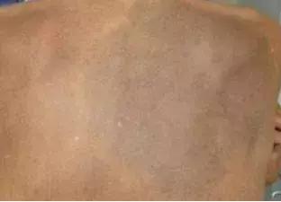 搓澡越勤越有泥,搓澡越搓死皮越多