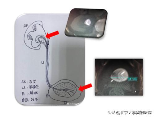 疯狂的石头泌尿外科,疯狂的石头北京