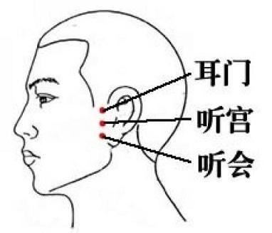 耳朵嗡嗡响一招解决最好办法,耳朵嗡嗡叫用什么方法能治好