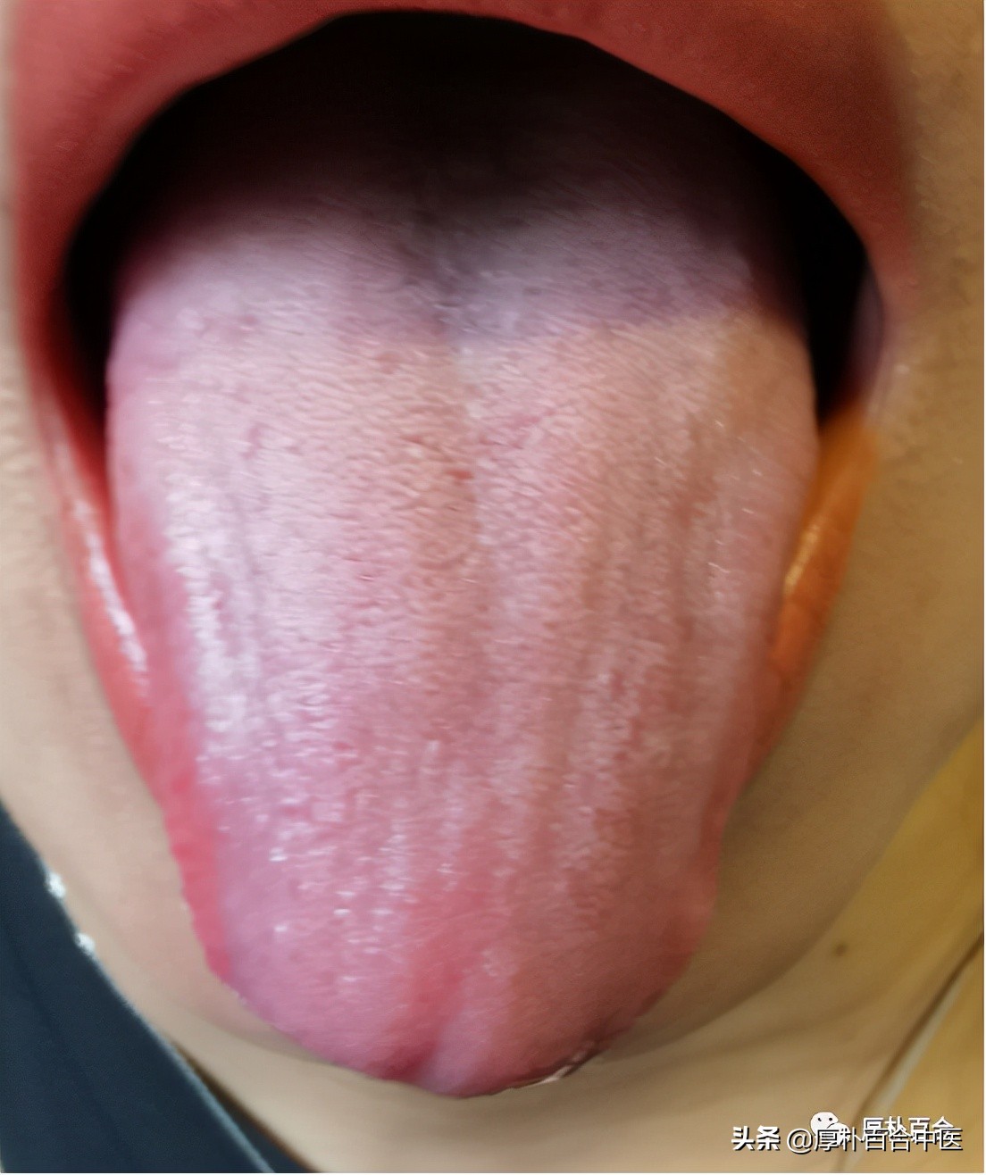 失眠与胆囊炎有关系吗,经前失眠还胃寒是什么原因