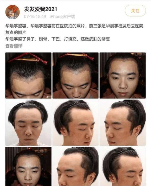 华晨宇被曝整容，本尊怒发声明，爆料者聊天截图曝光自揭背后阴谋