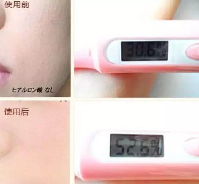 烟酰胺玻尿酸水光焕颜片美白效果,烟酰胺玻尿酸精华液美白淡斑霜