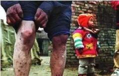 武汉肺炎，本可以不发生的。