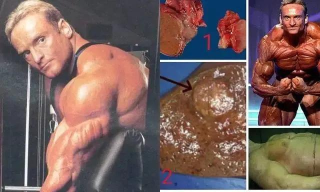 30岁暴毙！曾是是世界体脂最低的*男猛**！告诉你为何不能碰类固醇