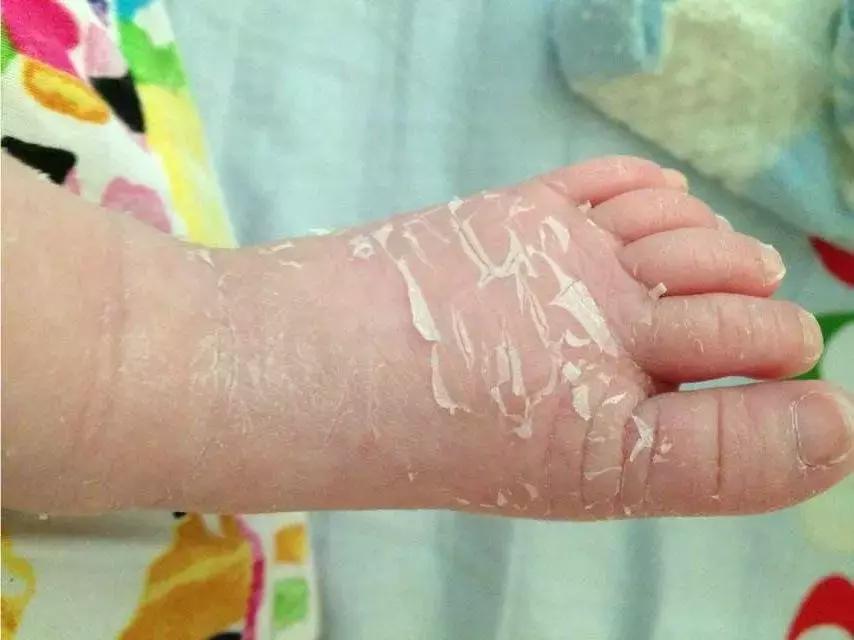 育婴师怎么处理宝宝疾病,育婴员关注婴幼儿发育状况