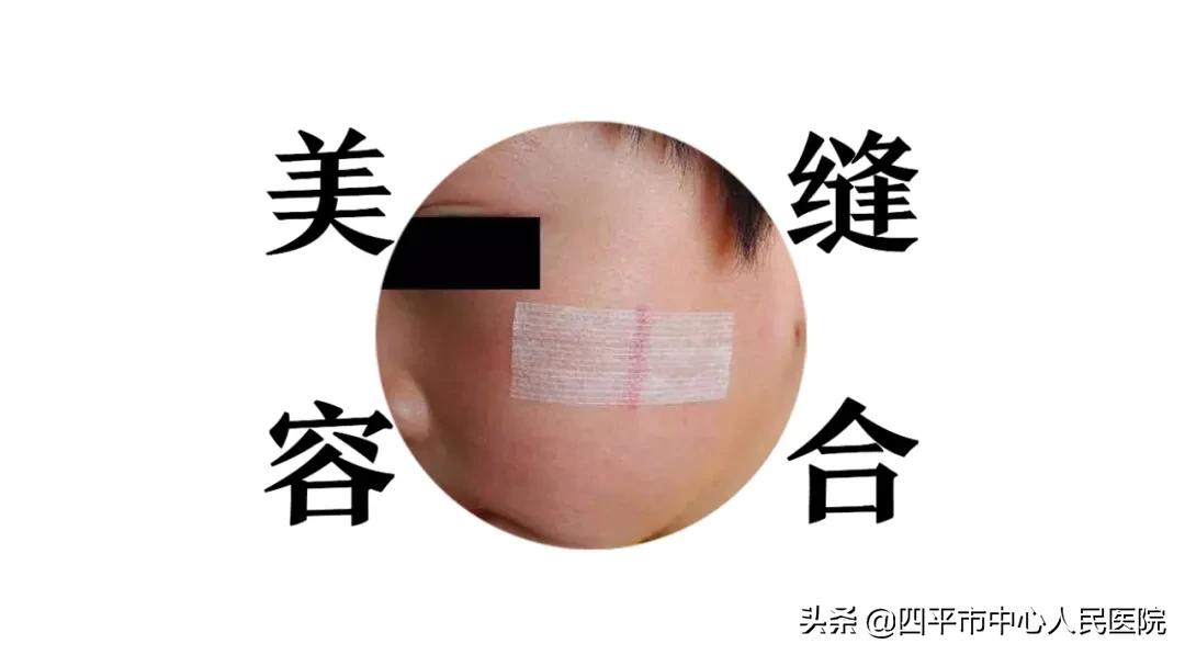 小儿的皮外伤怎么处理,小儿外伤缝合