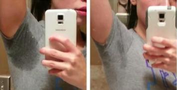 腋臭特效药一览表,miradry微波腋臭手术哪里可以做