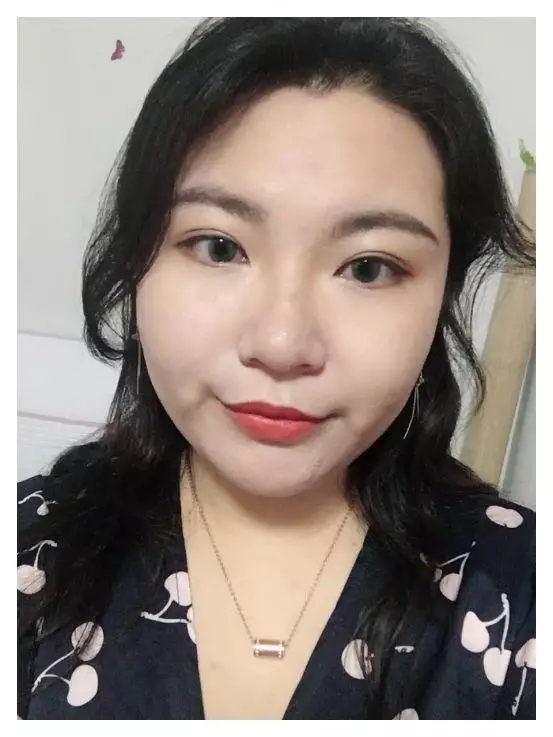 医美祛痘真实经历,微针祛痘坑真实经历