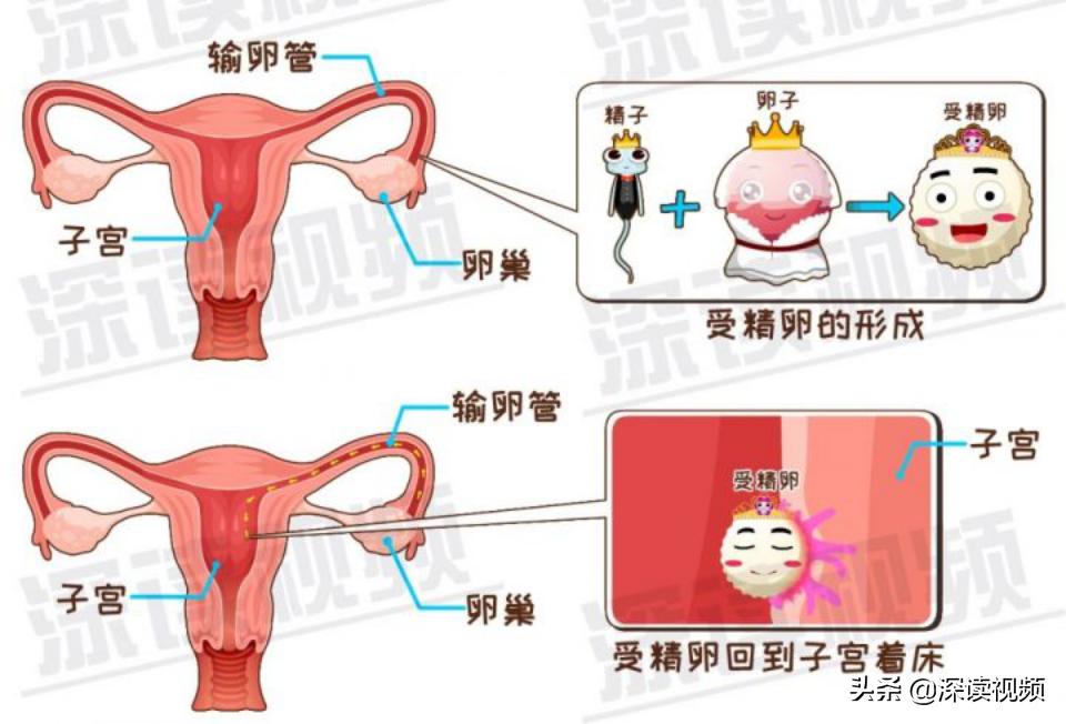 宫外孕一直流血怎么回事,宫外孕是怎么回事呢