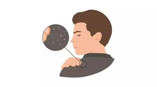 我一大老爷们原版,男士控油去屑洗发水挑选