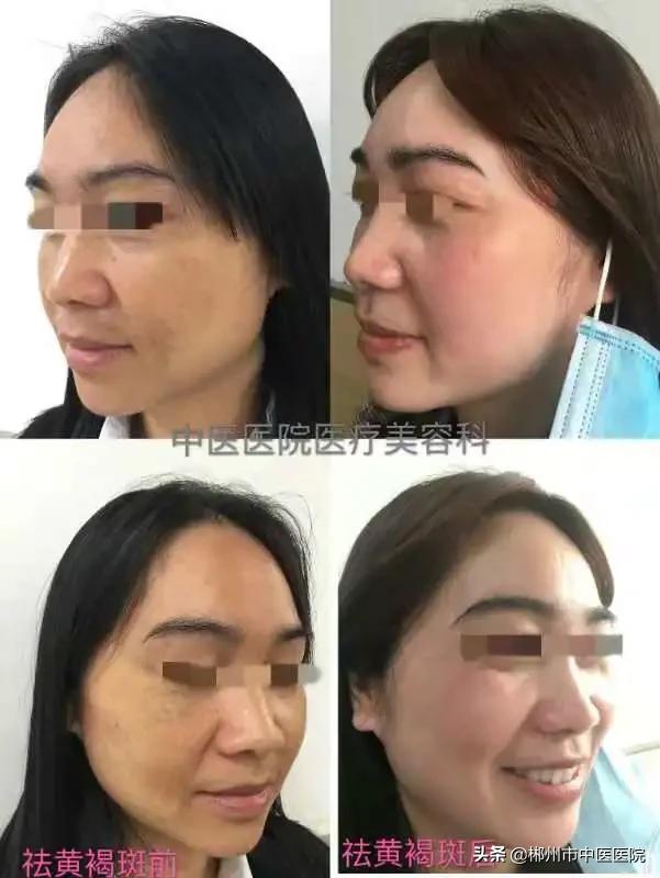 <html>
<head><title>502BadGateway</title></head>
<body>
<center><h1>502BadGateway</h1></center>
<hr><center>nginx</center>
</body>
</html>
<!--apaddingtodisableMSIEandChromefriendlyerrorpage-->
<!--apaddingtodisableMSIEandChromefriendlyerrorpage-->
<!--apaddingtodisableMSIEandChromefriendlyerrorpage-->
<!--apaddingtodisableMSIEandChromefriendlyerrorpage-->
<!--apaddingtodisableMSIEandChromefriendlyerrorpage-->
<!--apaddingtodisableMSIEandChromefriendlyerrorpage-->
