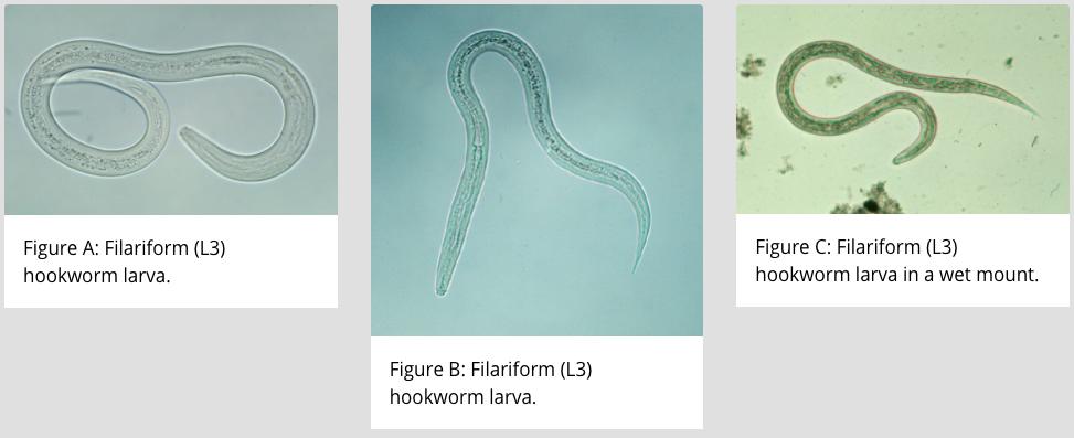 他们生吞3500寄生虫卵,花费1.5万元,只为治疗秃头
