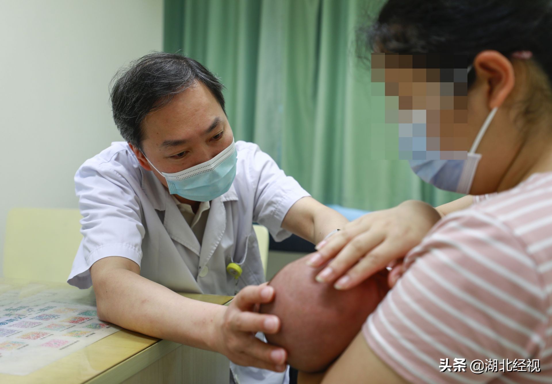 精灵耳的宝宝好看吗,小朋友精灵耳属于畸形吗