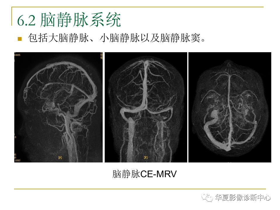 中国人脑立体定向mri应用解剖图谱,脑mri示意图